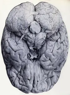 Friern Hospital, London: a brain, 1890-1910. Creator: Unknown