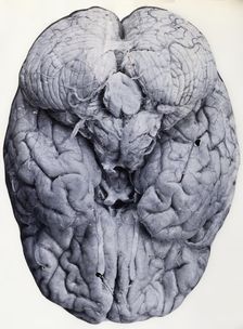 Friern Hospital, London: a brain, 1890-1910. Creator: Unknown