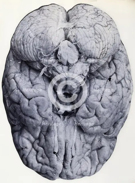 Friern Hospital, London: a brain, 1890-1910. Creator: Unknown.
