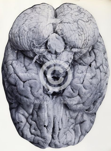 Friern Hospital, London: a brain, 1890-1910. Creator: Unknown.