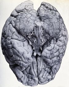 Friern Hospital, London: a brain, 1890/1910. Creator: Unknown