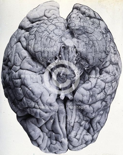 Friern Hospital, London: a brain, 1890/1910. Creator: Unknown.