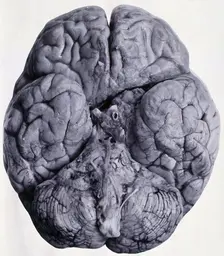 Friern Hospital, London: a brain, seen from beneath, 1890/1910. Creator: Unknown
