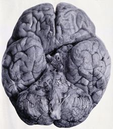 Friern Hospital, London: a brain, seen from beneath, 1890/1910. Creator: Unknown