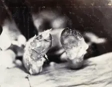 Friern Hospital, London: a child's feet viewed from below, 1890/1910. Creator: Unknown
