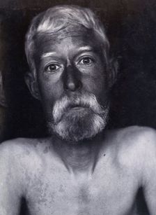 Friern Hospital, London: a patient, facing forwards, 1890/1910. Creator: Unknown