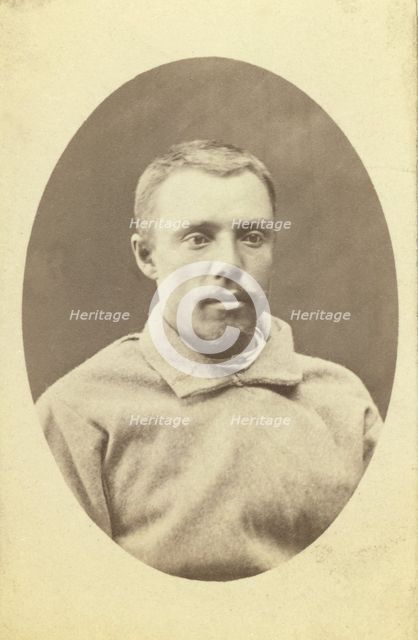 Head-and-shoulders portrait of a man, dressed in convict clothing, facing..., between 1880 and 1886. Creator: Unknown.