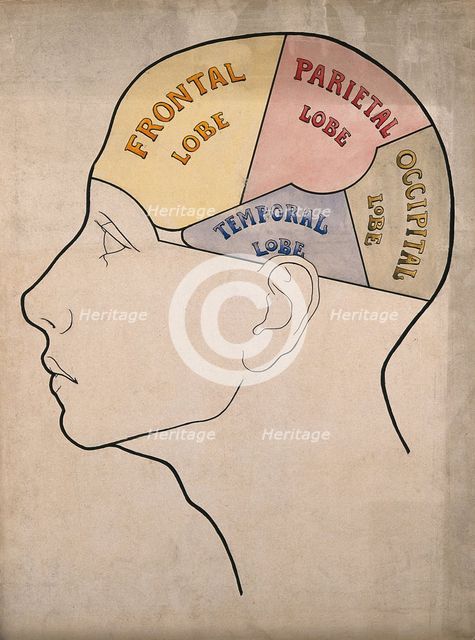 Head of "a backward boy" divided into four cerebral lobes: profile, c1900. Creator: Bernard Hollander.
