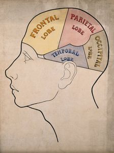 Head of "a backward boy" divided into four cerebral lobes: profile, c1900. Creator: Bernard Hollander
