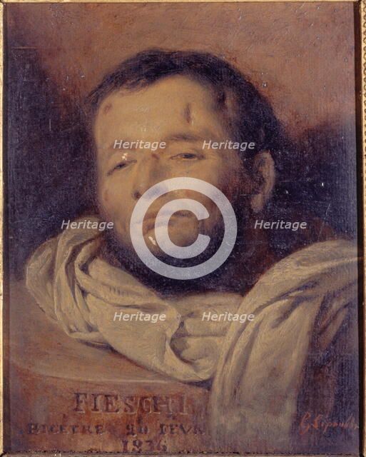 Head of Giuseppe Fieschi (1790-1836), after his execution, 1836. Creator: Francois-Gabriel-Guillaume Lepaulle.