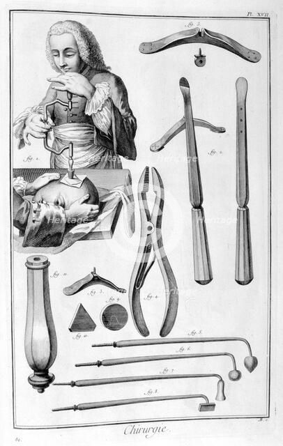 Head surgery, 1751-1777. Artist: Unknown
