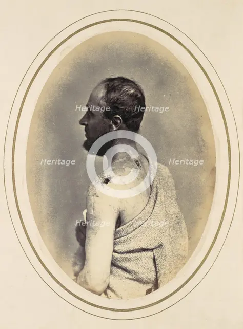 Henry Yon, 1865. Creator: Reed Brockway Bontecou.