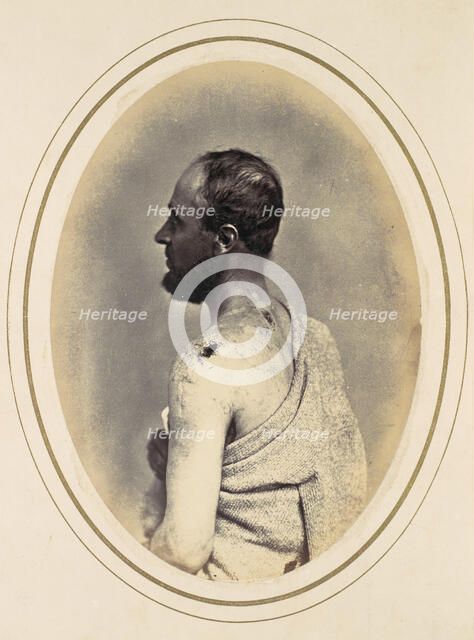 Henry Yon, 1865. Creator: Reed Brockway Bontecou.