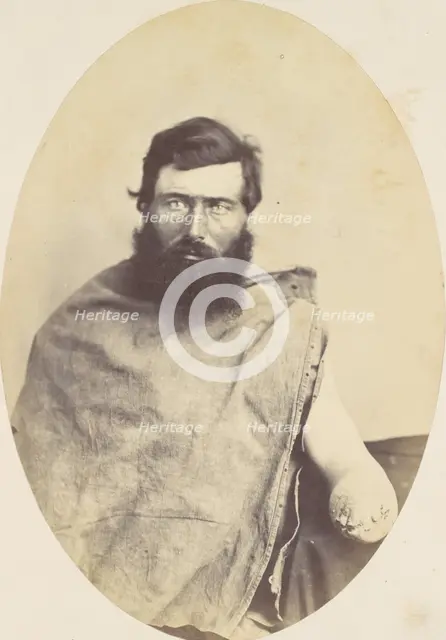 Herman Rice, 1865. Creator: Reed Brockway Bontecou.