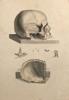 Human skull: six figures showing sections and an entire skull, 1830-1835. Creator: Unknown
