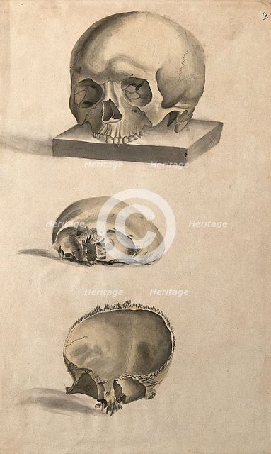 Human skull: three figures showing sections and an entire skull, 1830-1835. Creator: Unknown.