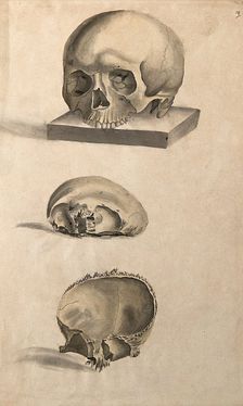 Human skull: three figures showing sections and an entire skull, 1830-1835. Creator: Unknown