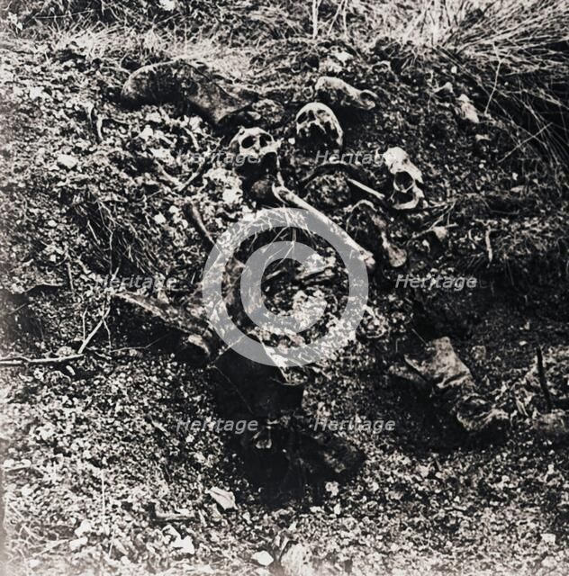 Human remains, c1914-c1918. Artist: Unknown.