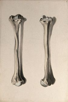 Humerus bone: two figures, 1830-1835. Creator: Unknown