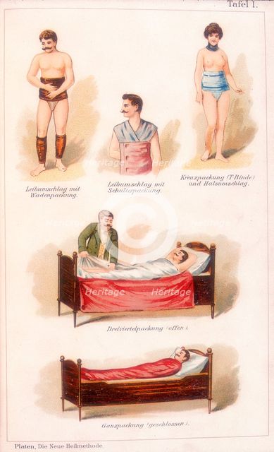 Hydrotherapy treatments, c1902. Creator: Unknown.