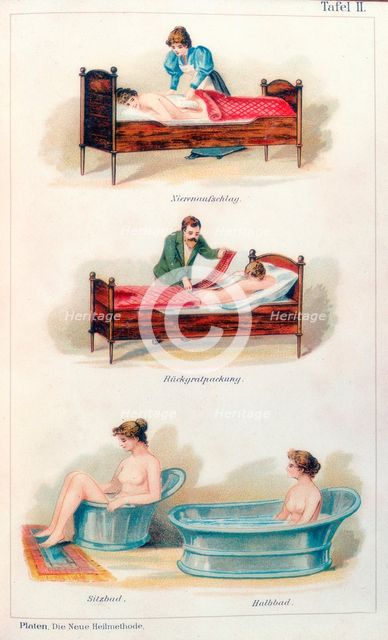 Hydrotherapy treatments, c1902. Creator: Unknown.