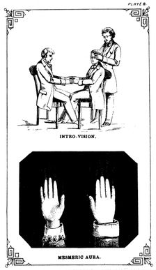 Hypnosis: introvision (power of looking into a body), 1889. Creator: Unknown
