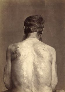 Invalid with 13 Brands, Punished Seven Times, 1891. Creator: Aleksei Kuznetsov