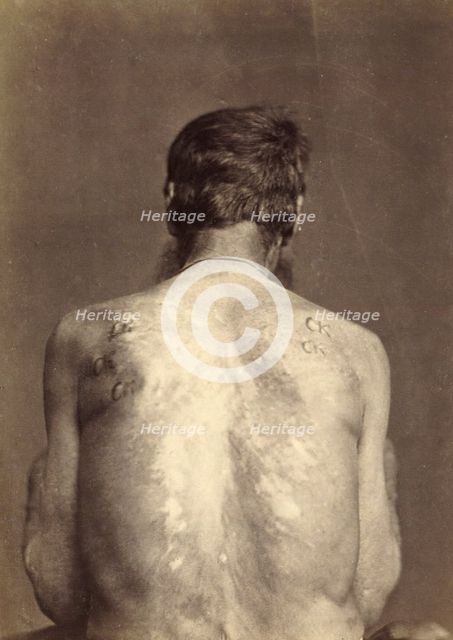 Invalid with 13 Brands, Punished Seven Times, 1891. Creator: Aleksei Kuznetsov.