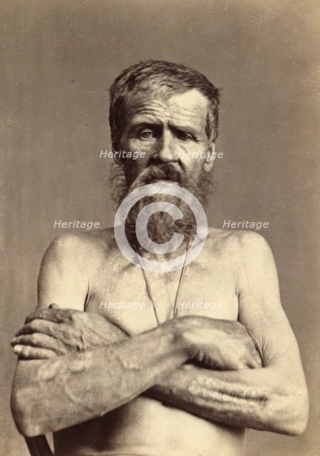 Invalid with 13 Brands, Punished Seven Times, 1891. Creator: Aleksei Kuznetsov.