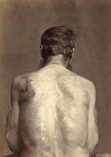 Invalid with 13 Brands, Punished Seven Times, 1891. Creator: Aleksei Kuznetsov