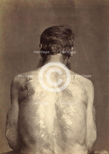 Invalid with 13 Brands, Punished Seven Times, 1891. Creator: Aleksei Kuznetsov.