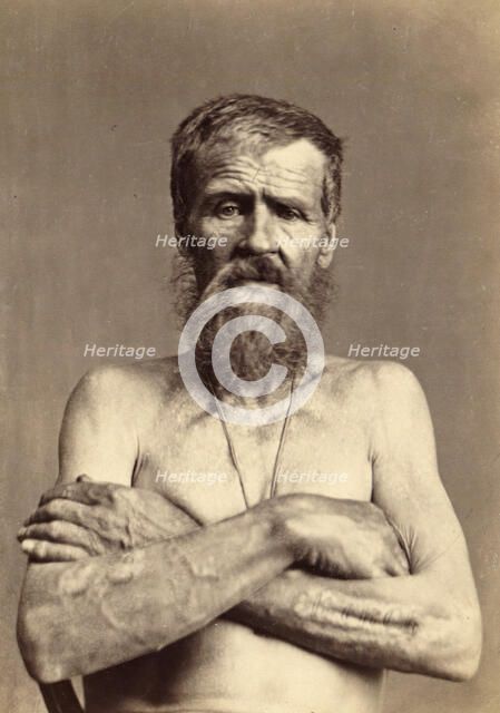 Invalid with 13 Brands, Punished Seven Times, 1891. Creator: Aleksei Kuznetsov.