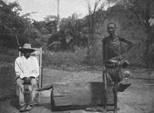 'Indigene du Congo atteint de la maladie du sommeil; L'Ouest Africain 1914. Creator: Unknown