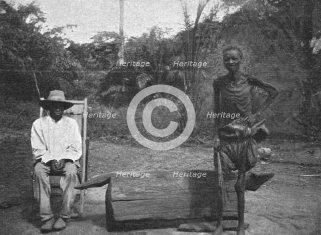 ''Indigene du Congo atteint de la maladie du sommeil; L'Ouest Africain', 1914. Creator: Unknown.