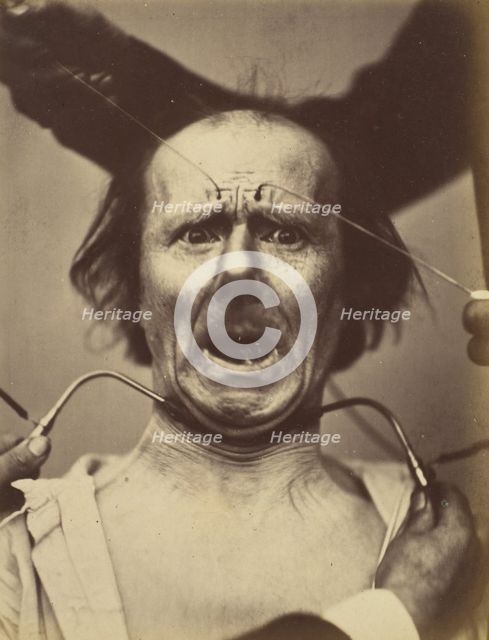 Icono-photographique. Mécanisme de la Physionomie Humaine. Fig. 65, 1854-56, printed 1862. Creators: Duchenne de Boulogne, Adrien Alban Tournachon.