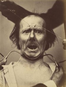 Icono-photographique. Mécanisme de la Physionomie Humaine. Fig. 65, 1854-56, printed 1862. Creators: Duchenne de Boulogne, Adrien Alban Tournachon