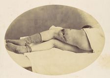 Judson C. Albright, 1865. Creator: Reed Brockway Bontecou