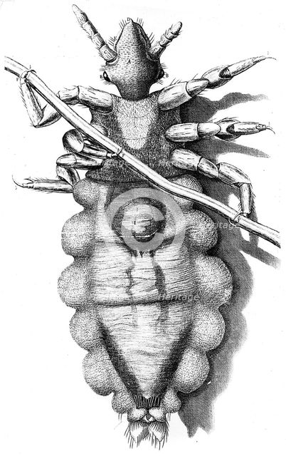 Louse clinging to a human hair, 1665. Creator: Unknown.