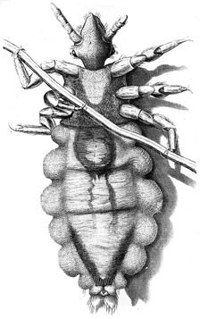 Louse clinging to a human hair, 1665. Creator: Unknown