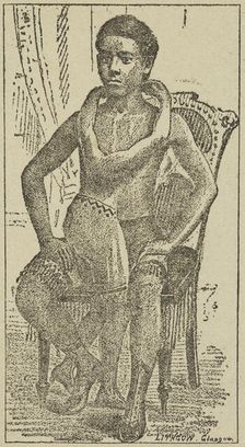 Lalloo, The Greatest Living Wonder on Earth, 1887. Creator: Unknown