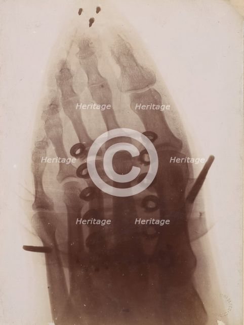 Le pied à travers la chaussure, 1896. Creator: Henri van Heurck.