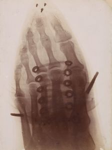 Le pied à travers la chaussure, 1896. Creator: Henri van Heurck