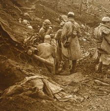 Les Éparges, northern France, 1915