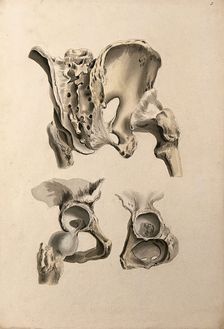 Ligaments of hip-bone and femur (thigh-bone), 1830-1835. Creator: Unknown