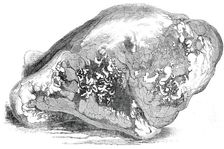 Lump of Gold from California - value £500, 1850. Creator: Unknown