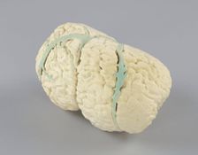 Model of the conjoined brains of Ladan and Laleh Bijani used by Dr. Ben Carson, 2003. Creator: Unknown
