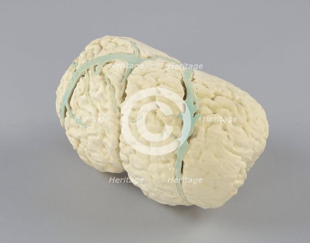 Model of the conjoined brains of Ladan and Laleh Bijani used by Dr. Ben Carson, 2003. Creator: Unknown.
