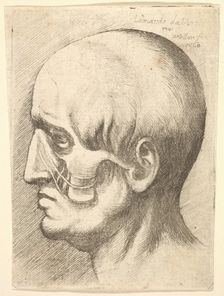 Male head in profile to left with muscles exposed, 1660. Creator: Wenceslaus Hollar