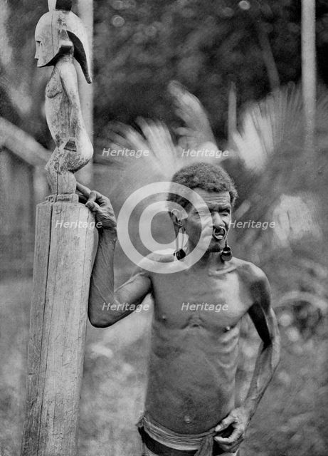 Malformation of the ears, Solomon Islands, 1920.Artist: JW Beattie