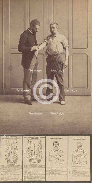 Notation of Scars, Schematic Drawings, ca. 1893., ca. 1893. Creator: Alphonse Bertillon.